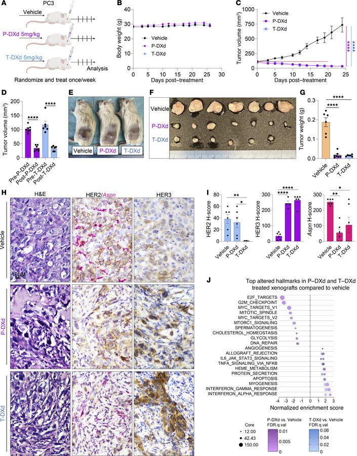 ADCs designed to target HER2 or HER3 restrict growth of prostate cancer ...