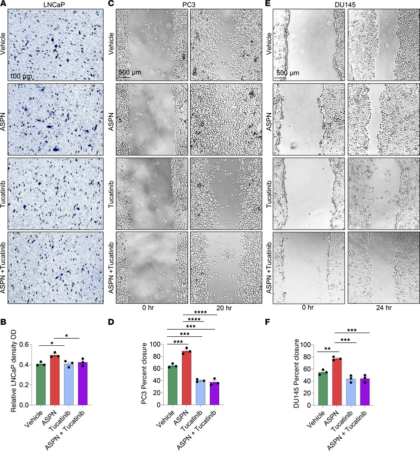 Tucatinib, a small molecule inhibitor of HER2, restricts ASPN-induced pr...