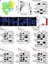 ASPN binds to the ligand binding domain of HER3.