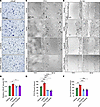 Tucatinib, a small molecule inhibitor of HER2, restricts ASPN-induced prost