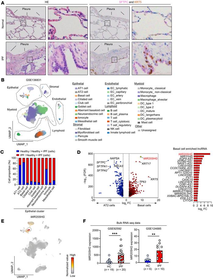 lncRNA MIR205HG is upregulated in basal cells.
(A) Representative images...