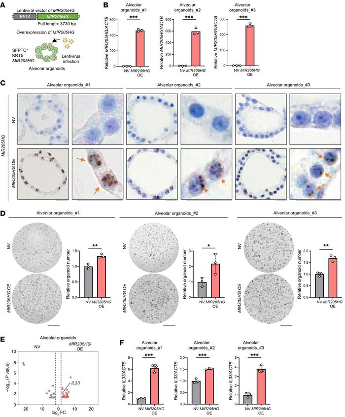Overexpression of lncRNA MIR205HG upregulates IL33 mRNA in alveolar orga...