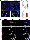 A subset of MIR205HG+ abnormal AT2 cells is increased in patients with IPF.