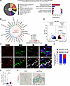 A subset of MIR205HG+ abnormal AT2 cells express IL-33 and exist in close p