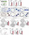 Overexpression of lncRNA MIR205HG upregulates IL33 mRNA in alveolar organoi