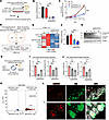 Downregulation of MIR205HG decreases IL33 mRNA and IL-33 protein expression