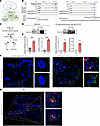 MIR205HG and IL33 mRNA binds to fused in sarcoma RBP in NHBE cells and IPF