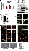 MT-JIP3 induces JNK signaling, disrupts cargo endosome mobility, and causes