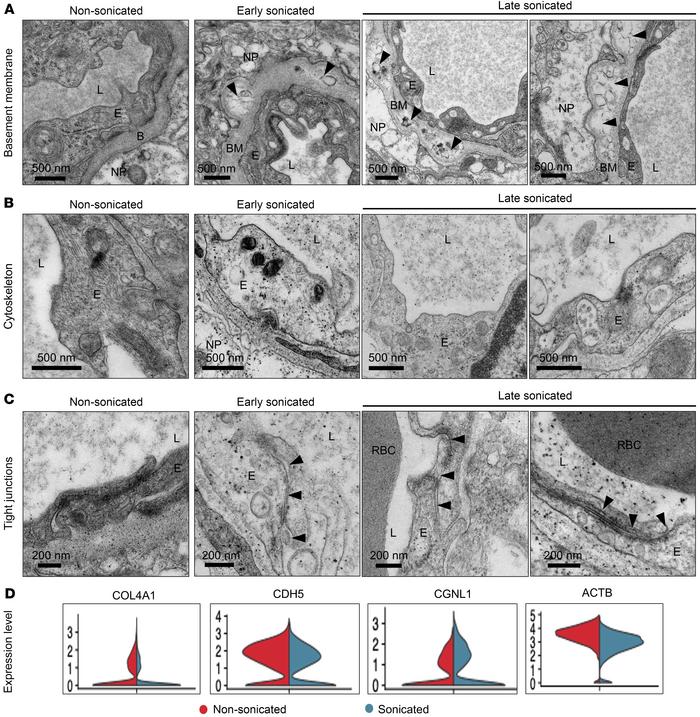 Ultrastructural alterations to brain capillaries following LIPU/MB-media...