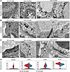 Ultrastructural alterations to brain capillaries following LIPU/MB-mediated