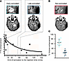 Radiographic estimate of BBB closure kinetics following acute disruption by