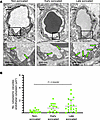 LIPU/MB-mediated BBB disruption increases endothelial cytoplasmic vacuoles