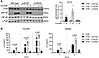 Stimulation of TLR8 A518T variant induces p–NF-κB and cytokine release.