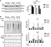 TLR8 A518T variant reduces protein abundance and increases degradation.