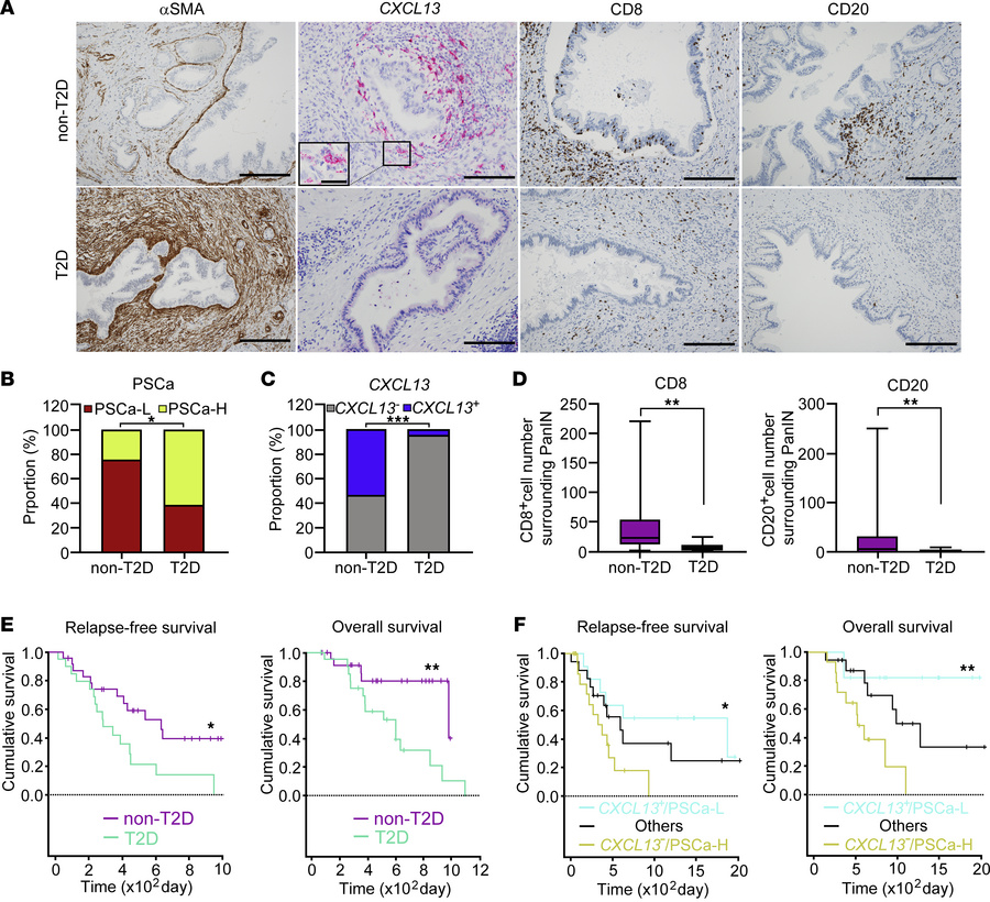 PSC activation score and CXCL13 expression around PanIN lesions in human...