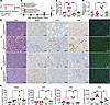 Effects of DIO on tumor immunity in allogeneic transplantation–model mice w