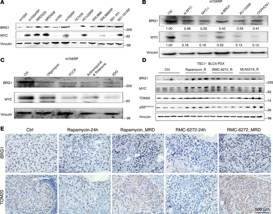 MRD tumors developed in vivo exhibit upregulated MYC and BRG1.
(A) BRG1 ...
