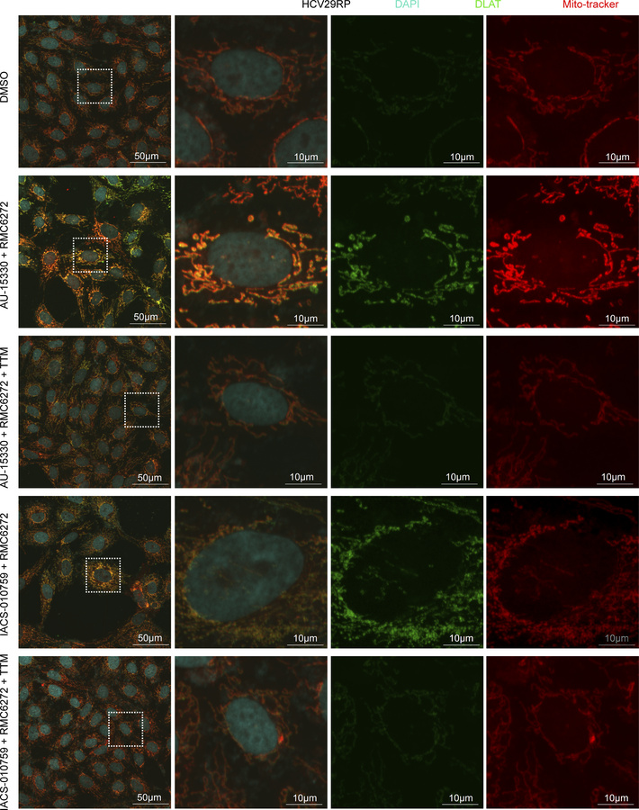 RP cells are hypersensitive to cuproptosis induction by combination of S...