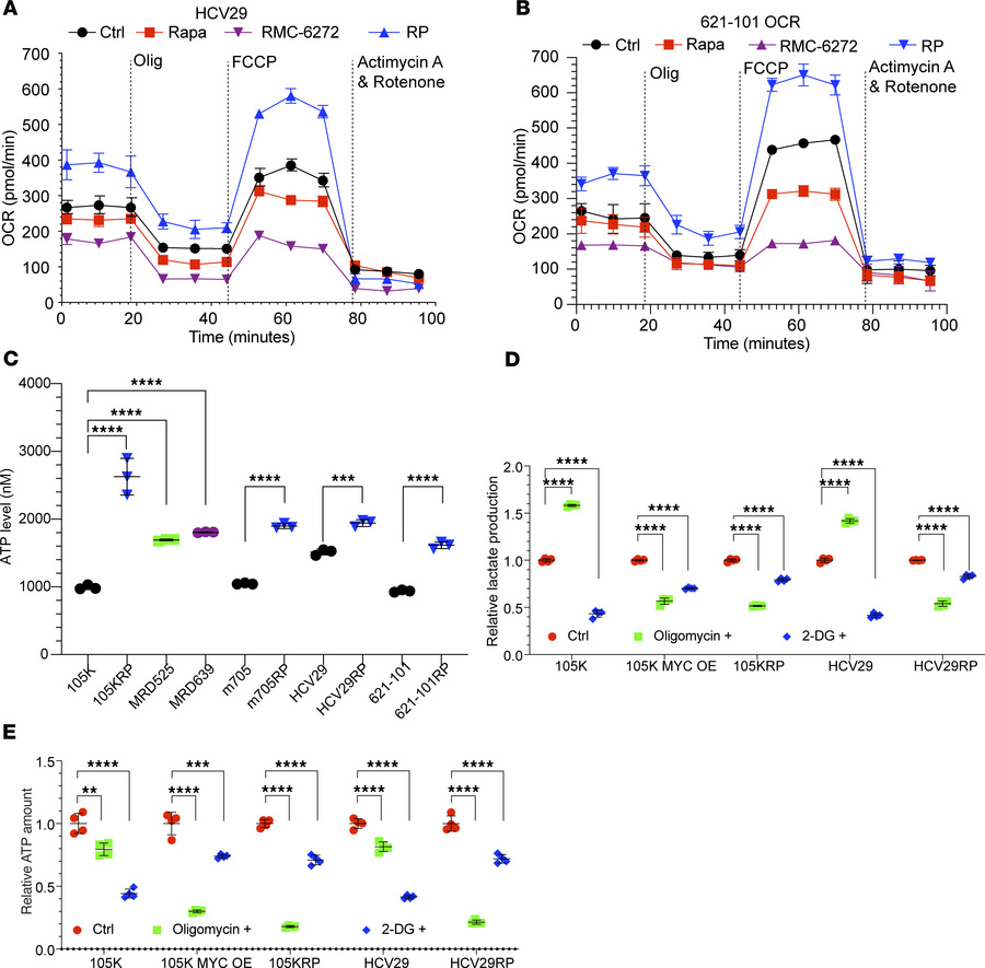 RP cell lines have upregulated OXPHOS.
(A) Seahorse assay data for untre...
