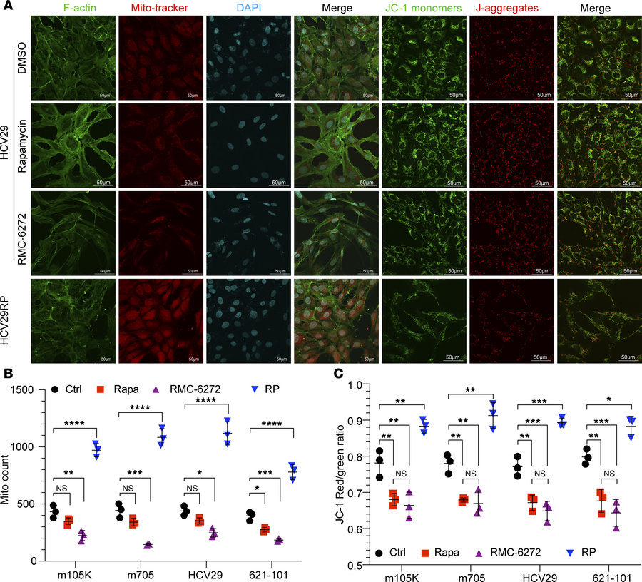 RP cells have increased numbers of mitochondria.
(A–C) RP cells have inc...