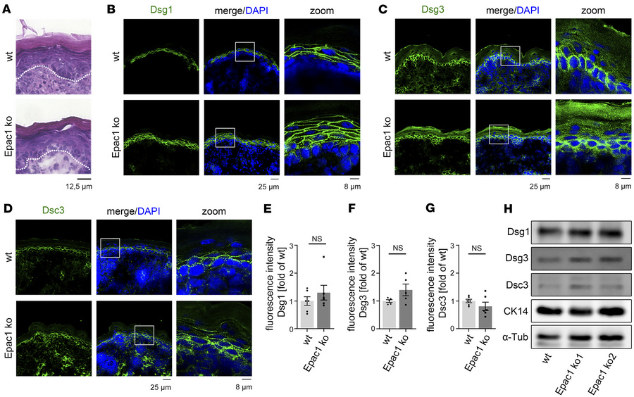 Epidermis of Epac1-ko mice shows no alterations.
(A) H&amp;E staining of...