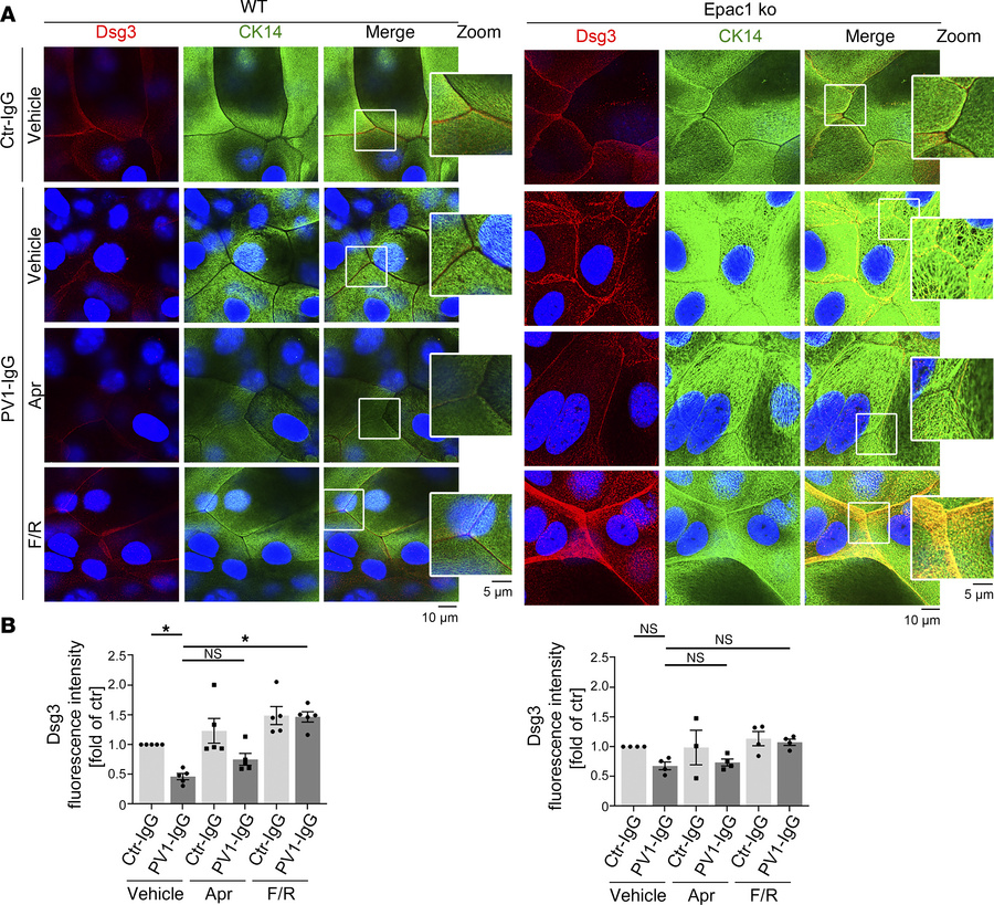 Apremilast rescues PV-IgG-induced alteration of keratins Epac1 dependent...