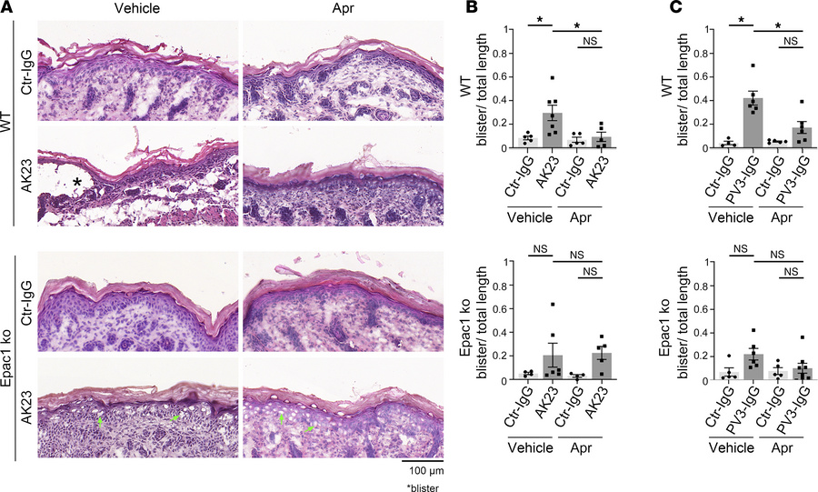 Epac1 depletion attenuates blistering in the pemphigus mouse model and a...