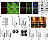 Murine Epac1-ko keratinocytes display upregulated desmosomal proteins and s