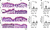 Epac1 depletion attenuates blistering in the pemphigus mouse model and abro