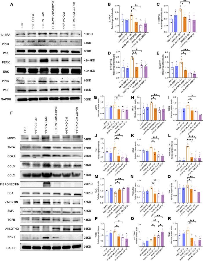 IL-17A inhibitor attenuated the activation of the IL-17 signaling pathwa...