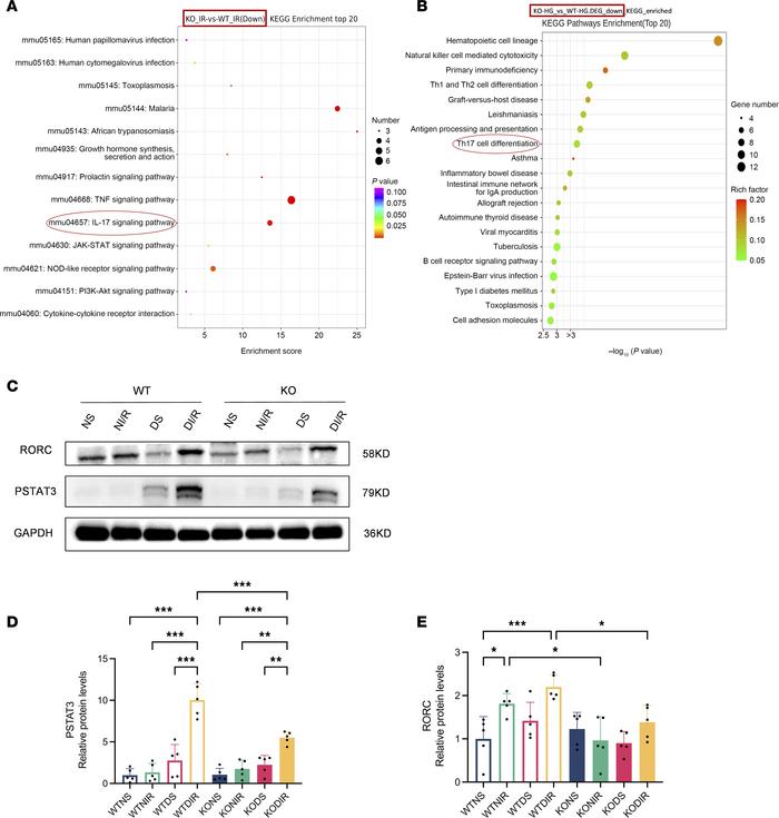 
RasGRP4 promoted the differentiation of CD4+ T cells to Th17 cells in t...