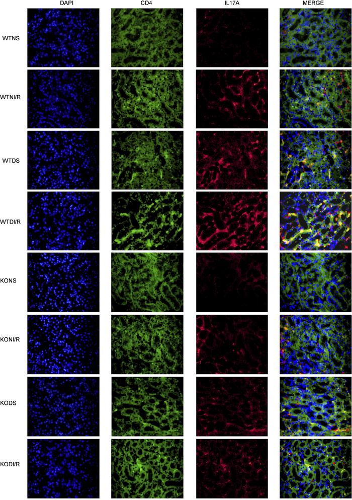 
RasGRP4 promoted infiltration of Th17 cells in the kidneys of diabetic ...