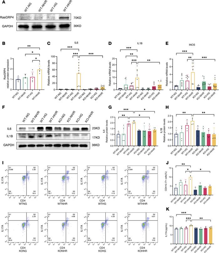 
RasGRP4 was upregulated in high glucose–cultured macrophages treated wi...