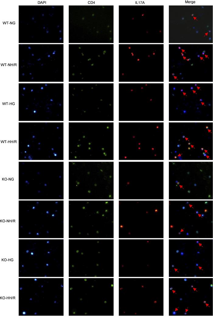 RasGRP4 promoted the differentiation of Th17 cells in peripheral blood m...