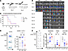 CD8+ T cells overexpressing PDH regulatory enzymes show compromised efficac