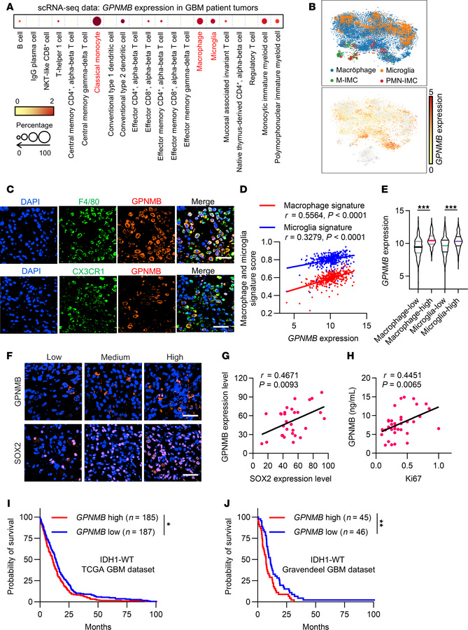 GPNMB is a prognostic biomarker correlating with TAM prominence and GSC ...