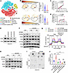GPNMB induces GSC glycolysis and stemness through CD44.