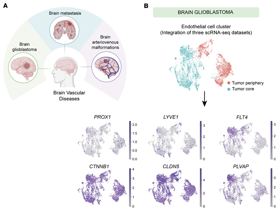 LEC markers and the vascular permeability marker PLVAP are upregulated i...