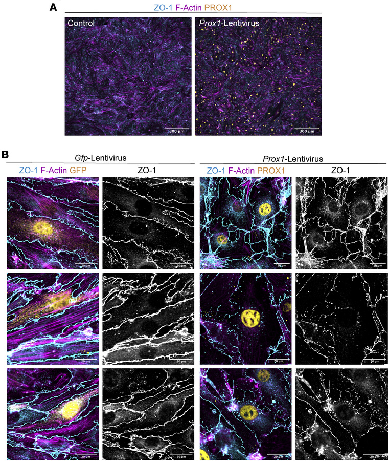 
Prox1 overexpression disrupts TJs in cultured brain ECs.
(A) Representa...