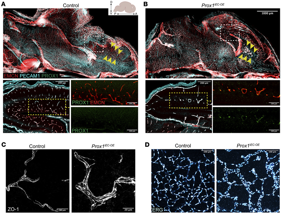 Endothelial Prox1 overexpression disrupts CNS vascular development.
(A a...