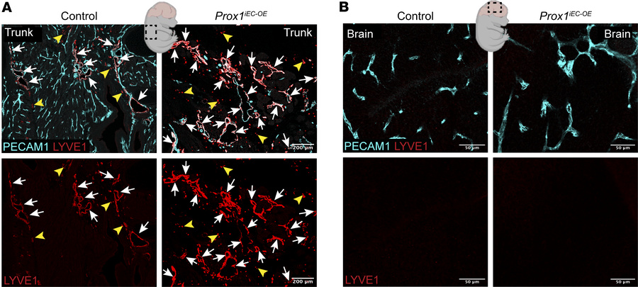 Endothelial Prox1 does not induce conventional lymphatic vessels in deve...