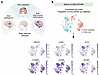 LEC markers and the vascular permeability marker PLVAP are upregulated in E
