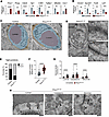 Postnatal Prox1 induction disrupts TJs and increases transcytosis.
