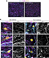 Prox1 overexpression disrupts TJs in cultured brain ECs.