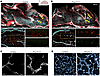 Endothelial Prox1 overexpression disrupts CNS vascular development.