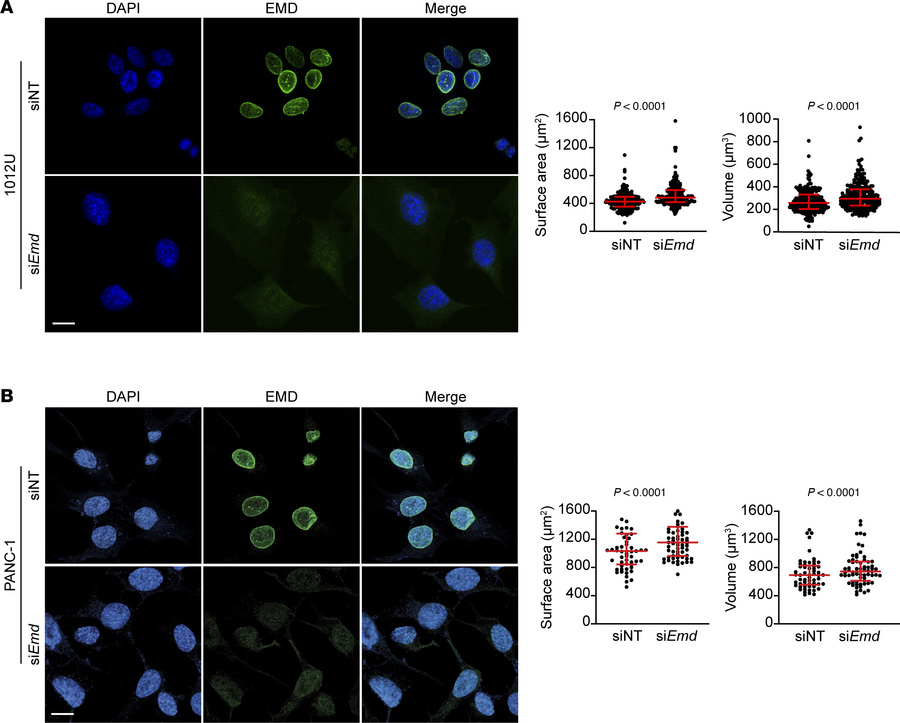 EMD is required by KRASG12D to regulate nuclear size.
(A) IF of +Dox con...