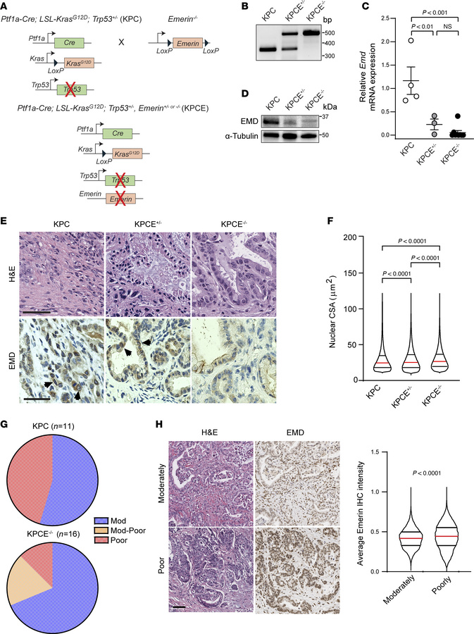 EMD is an effector of nuclear size change downstream of oncogenic KRAS i...