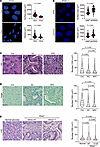 KRASG12D induces nuclear size reduction in PDAC.