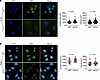 EMD is required by KRASG12D to regulate nuclear size.