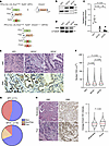 EMD is an effector of nuclear size change downstream of oncogenic KRAS in v